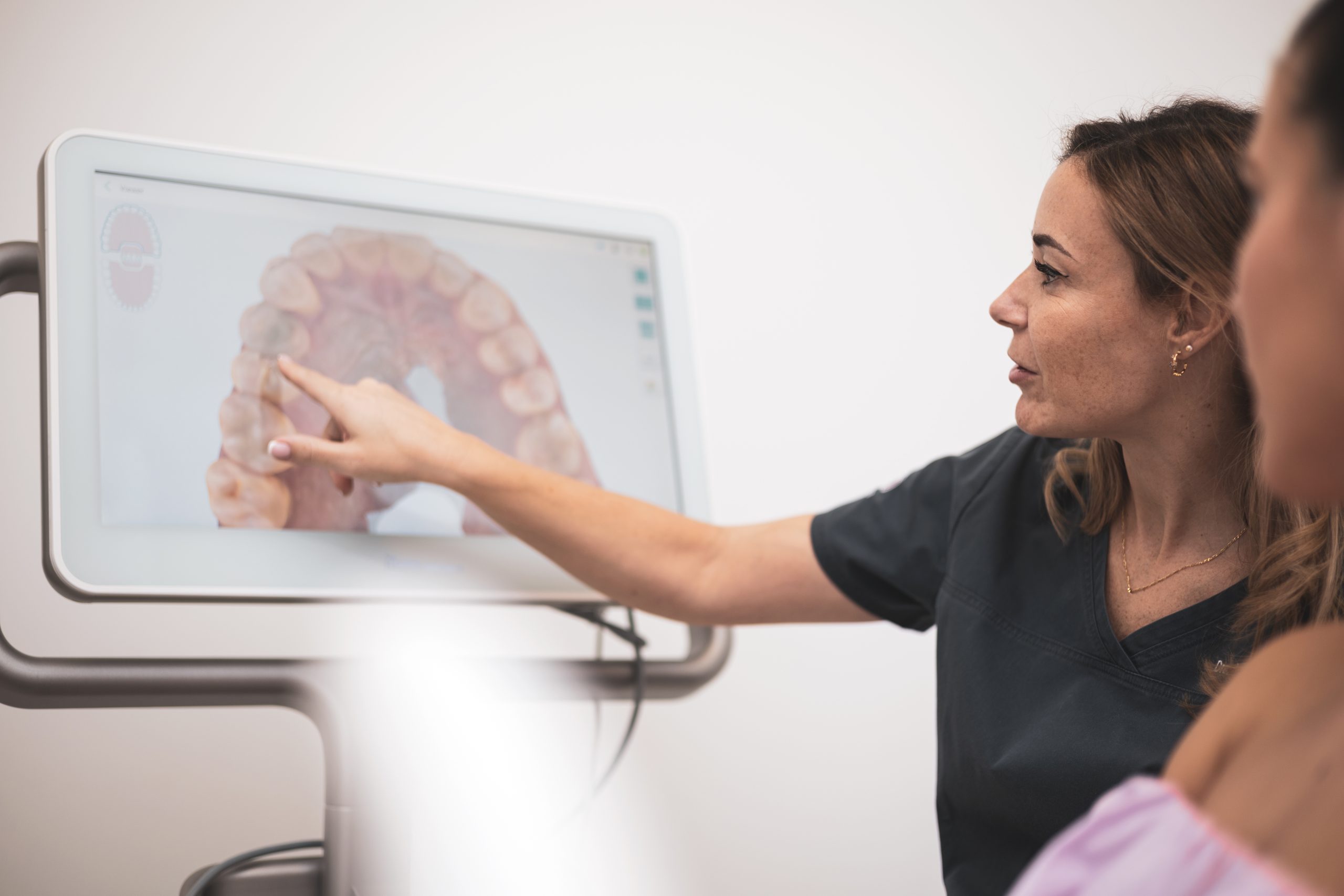 A woman dentist showing the patient on the screen the teeth after having used the 3d dental scanner, screen with 3d.Intraoral scanning.